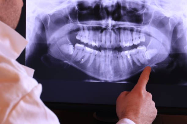 Best Emergency Root Canal Therapy in Svis, IL